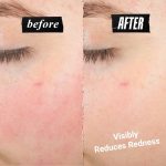 Kiehl’s Ultra Facial Meltdown Recovery Cream Model Shot 2